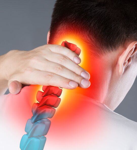 Cervical osteochondrosis symptoms